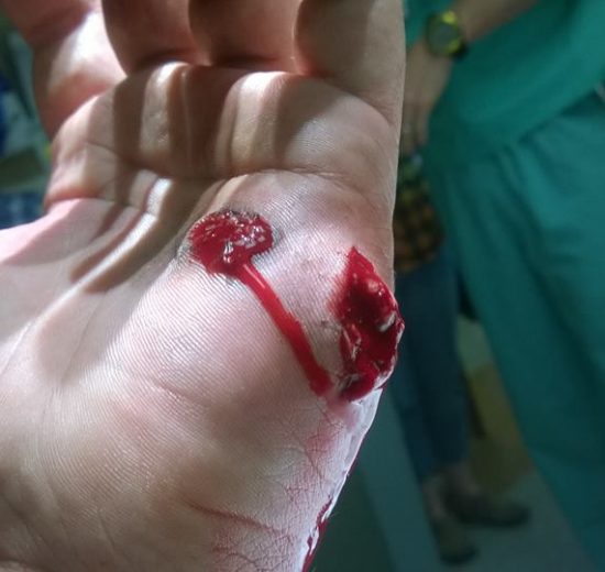 tiro defensivo peru accidentes con armas de fuego